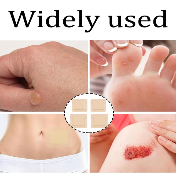 4 PCS Bed Sore Dressing, 7.5x7.5cm and 10x10cm Wound Care Pads for Pressure Ulcers, Elderly and Bedridden Patients, Post Care - Image 2