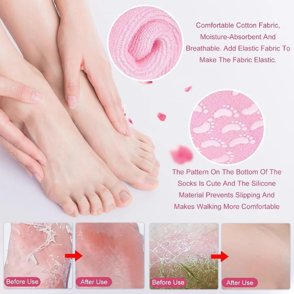 Aarugo Anti-Crack Silicone Foot Protector Socks (Pack of 1) – Half-Length Moisturizing Heel Care Socks for Cracked Heels & Foot Pain Relief, Suitable for Men & Women (Multicolor) - Image 2