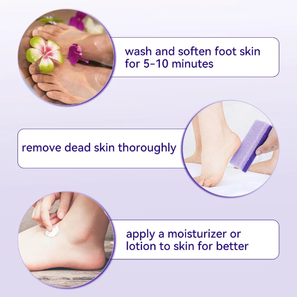 4 Pcs Foot Pumice Stone Set – Callus Remover & Heel Scrubber for Dead Skin Exfoliation (Purple) - Image 4