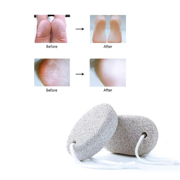 1PCS Foot Care Exfoliating Scrub Stone Dead Skin Remove Pedicure Scrubber Natural Pumice Stone Foot File - Image 3