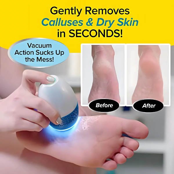 24x7 eMall Professional Callus Remover Filer Pedicure Device for Feet with Built-in Vacuum Electric Callus Remover for Mess-Free Exfoliation Foot File Removes Dead Skin from Feet. - Image 2