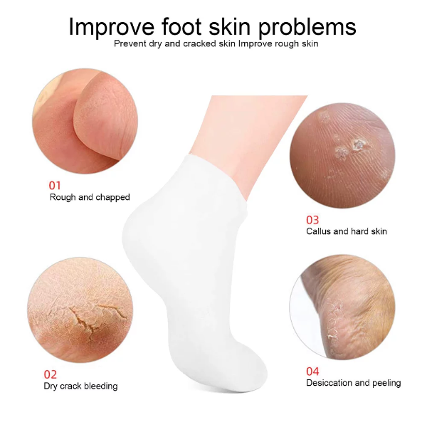 2 Pairs SEBS Exfoliating Moisturizing Socks, Elastic Anti Cracking Preventing Dryness, Rejuvenating Foot Protection Socks, Foot Skin Care Socks(L(39-41)) - Image 2