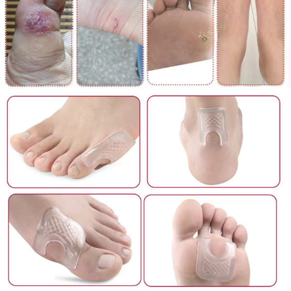 10 Pcs U-Shaped Gel Callus Pads, Waterproof Callus Protectors 1/8 from Rubbing on Shoes, Reusable Callus Cushions - Image 3
