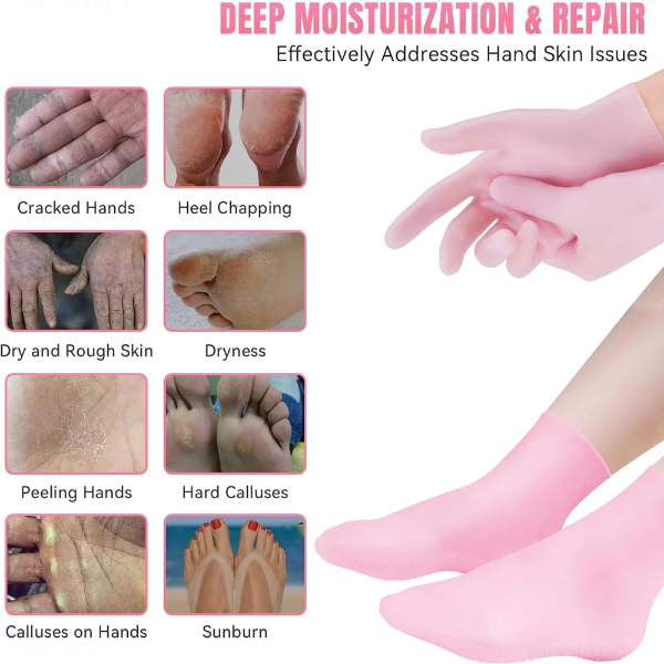 2Pairs Silicone Gel Glove & Sock Foot Care Set Spa Pedicure AntiSlip Moisturizing Socks & Hand Softening Gloves for Dry Cracked Skin - Image 4