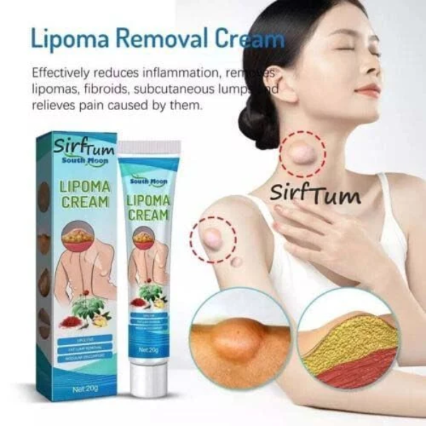 30gLipoma Removal Cream, Lipoma Removal Cream Ointment, Lipoma Elimination Cream, for Lipoma Treatment Cellulite Removal Cream, Anti-Swelling Lymphatic Detox Ointment (Pack of 3) - Image 2