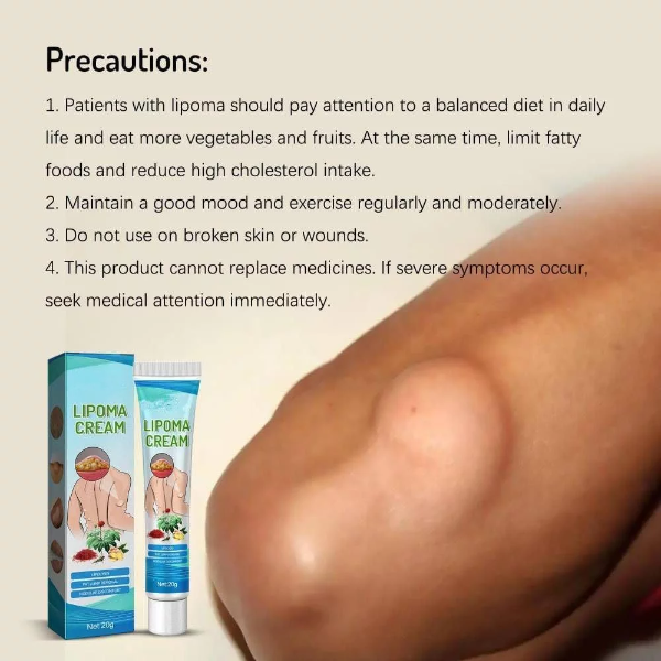 30gLipoma Removal Cream, Lipoma Removal Cream Ointment, Lipoma Elimination Cream, for Lipoma Treatment Cellulite Removal Cream, Anti-Swelling Lymphatic Detox Ointment (Pack of 2) - Image 3