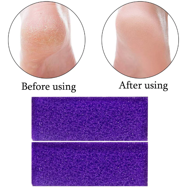 40 Pcs Pumice Stone For Feet Foot Scrubber Sponge For Feet Care and Callus Remover Mini Disposable Pumice Pads For Dead Skin Remover Purper. - Image 2