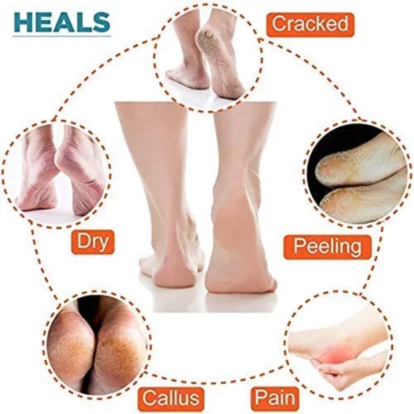 AAR BEE WORLD Silicone Gel Half Heel Socks for Anti-Crack Foot Care & Moisturizing Heel Protection – Multicolor - Image 4