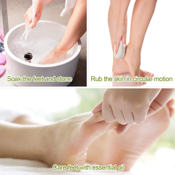 2-Pack Natural Pumice Stone for Feet, Feelhigh Lava Pedicure Tools Hard Skin Callus Remover for Feet and Hands - Natural Foot File Exfoliation to Remove Dead Skin, Heels, Elbows, Hands - Image 4