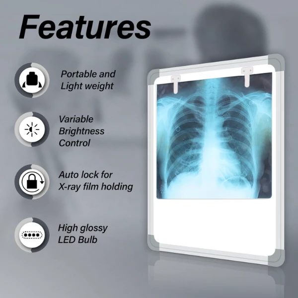 OTICA Fully Automatic LED X-Ray View Box With 1 Year Warranty X-Ray Box With Variable Brightness Control For Hospital, Clinic (Extra Bright LED) - Image 2