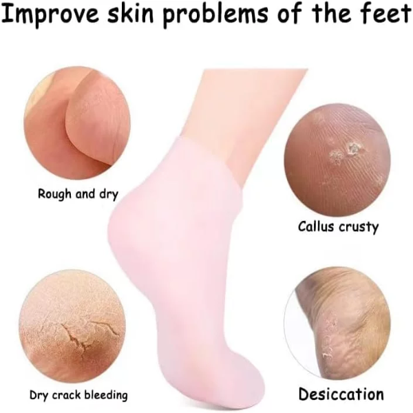 1 Pairs Overnight Moisturizing Socks, Moisturizing Spa Socks, Overnight Absorption, For Dry, Cracked Feet, For Men and Women - Image 4