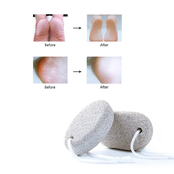 1PCS Foot Care Exfoliating Scrub Stone Dead Skin Remove Pedicure Scrubber Natural Pumice Stone Foot File - Image 3