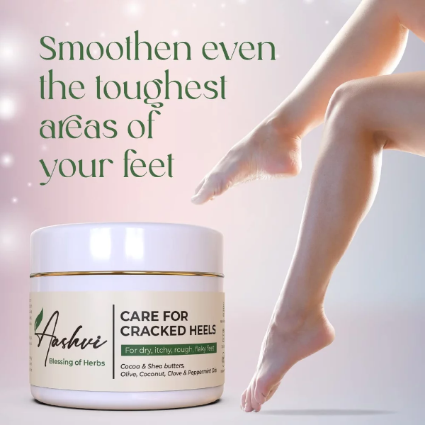 Aashvi Herbs Cracked Heel Repair Cream (40g) – Deep Moisturizing Treatment for Dry, Itchy, Rough & Flaky Feet - Image 3