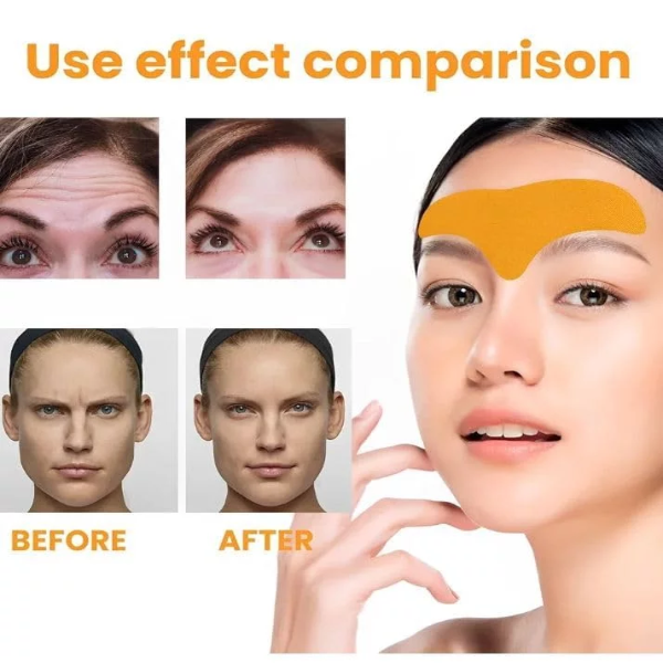 10PCS Forehead Wrinkle Patches | Anti-Wrinkle Forehead Pads-Smooth Face Mask With Hydrolysed Collagen Face Treatment Multipurpose (10PCS) - Image 2