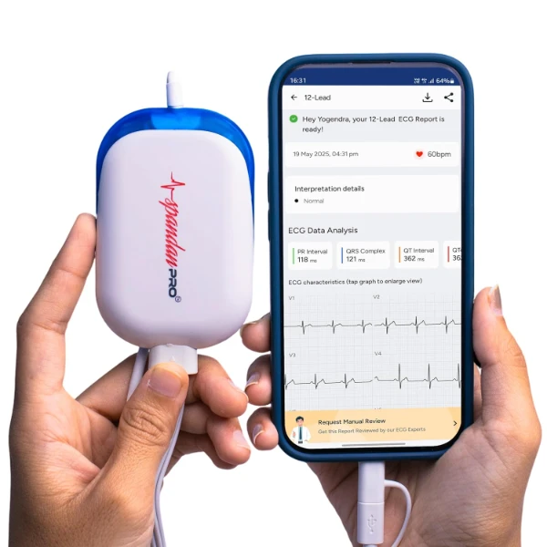 Sunfox Spandan Pro portable ECG machine paired with an Android smartphone for clinical diagnostics.