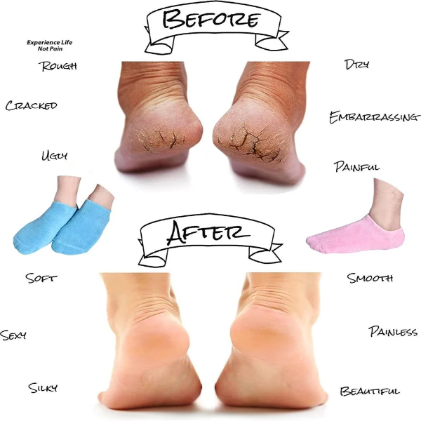 4Mura Moisturizing Socks for Women – 2 Pair Pack Heel Spa Socks for Dry, Cracked Feet Care, Hydrating Lotion Locking Foot Treatment Socks (Multi-Color) - Image 2