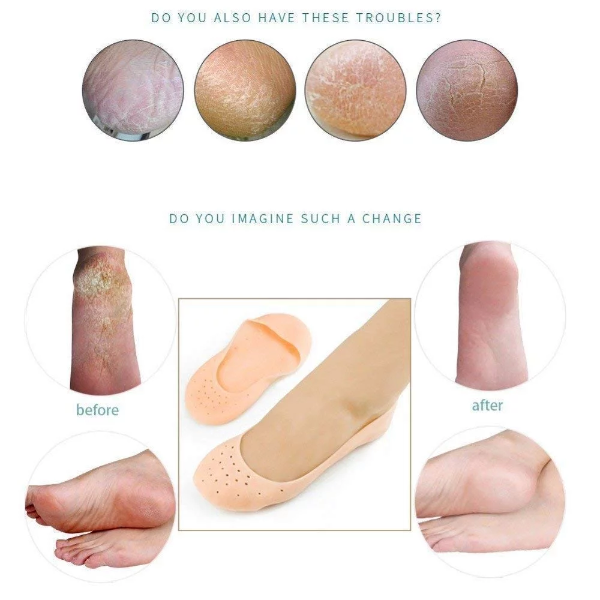 2V BROTHERS Anti Crack Full Length Silicone Foot Protector Moisturizing Socks for Foot- Care and Heel Cracks;socks for cracked feet;heel pad for heel pain;anti crack heel socks moisturizing silicone gel - Image 3