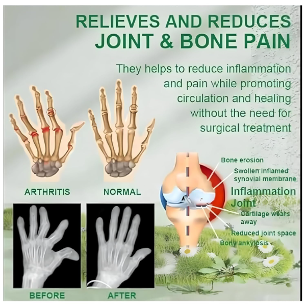 Dhurandar Ayurvedic Joint & Muscle Oil - 100ml | Topical Pain Relief for Arthritis, Sciatica & Sports Injuries | Extra Strength Herbal Blend for Chronic Pain | 100% Natural & Fast Acting - Image 4