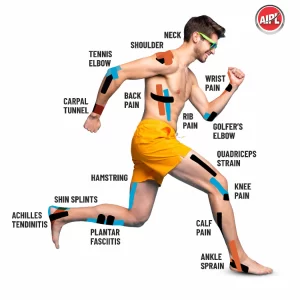 AIPL Zorrofit waterproof athletic kinesiology tape.